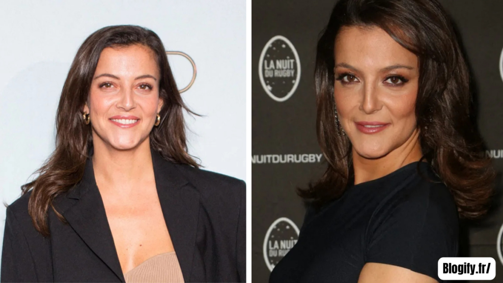 camille lellouche chirurgie